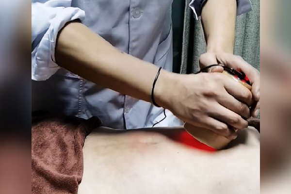 纳入湖南省针灸学会针灸防治新型冠状病毒肺炎指导意见